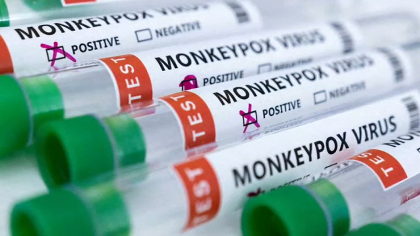 Valley community leaders trying to fight misinformation on monkeypox