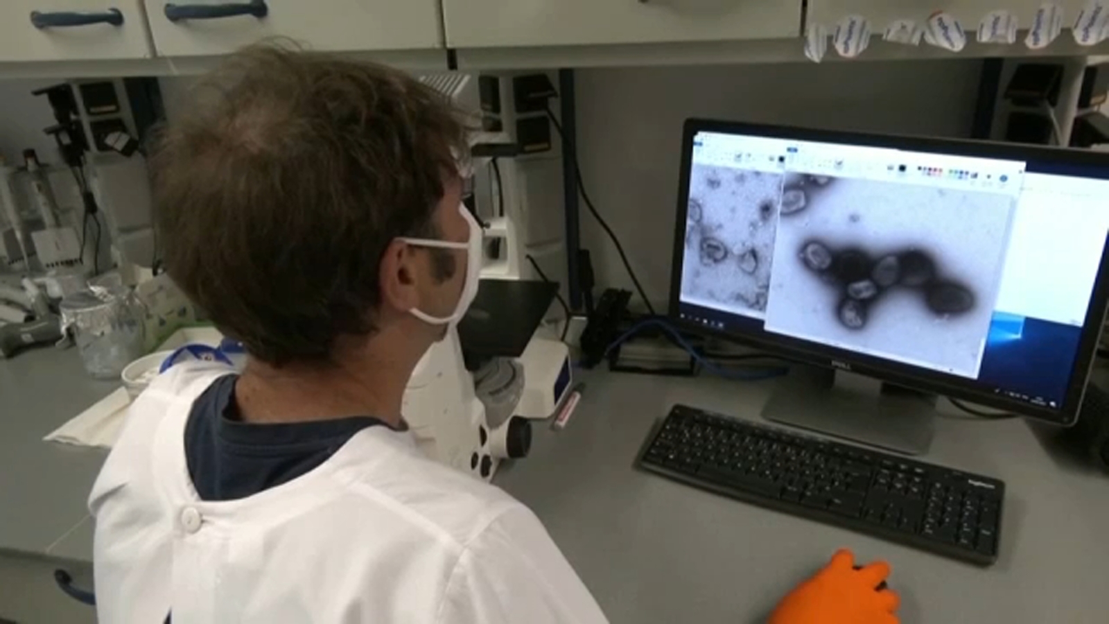3 more people test positive for monkeypox in Fresno County, cases now up to 7