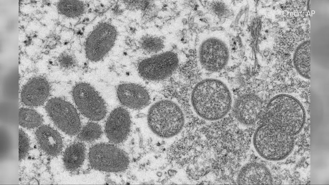 Monkeypox DNA found in Sacramento area wastewater