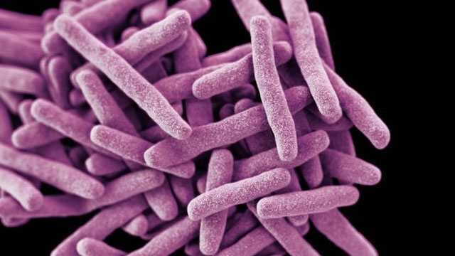 Hiram Johnson High School student diagnosed with active TB
