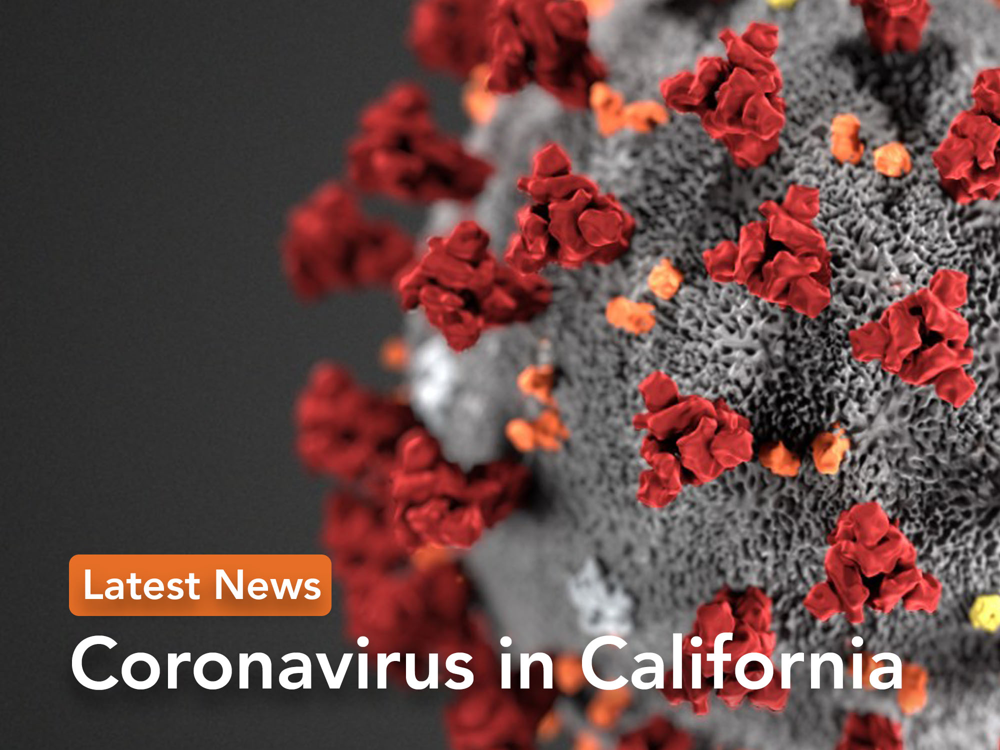 California coronavirus updates: Sacramento County COVID-19 case rate remains low